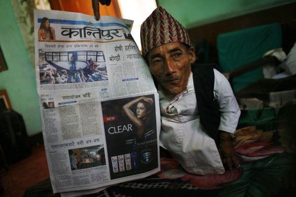 Foto: Nepalec se poteguje za naslov najnižjega človeka na svetu