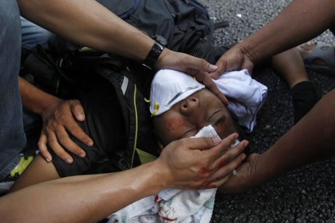 Foto: Policija s solzivcem nad 25.000 protestnikov na ulicah Kuala Lumpurja