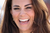 Popolno zobovje preveč umetno za Kate Middleton: Francoski dentalni kirurg prisega na 'harmonično asimetrijo'
