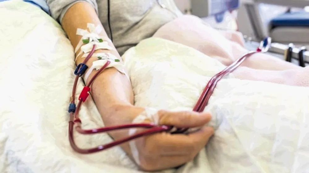 Dializa v povprečju traja &scaron;tiri ure, k temu pa je treba pri&scaron;teti &scaron;e čas za priklapljanje bolnika na aparat  in odklapljanje ter čas, ki ga bolnik potrebuje za prevoz do dializnega centra in nazaj domov.