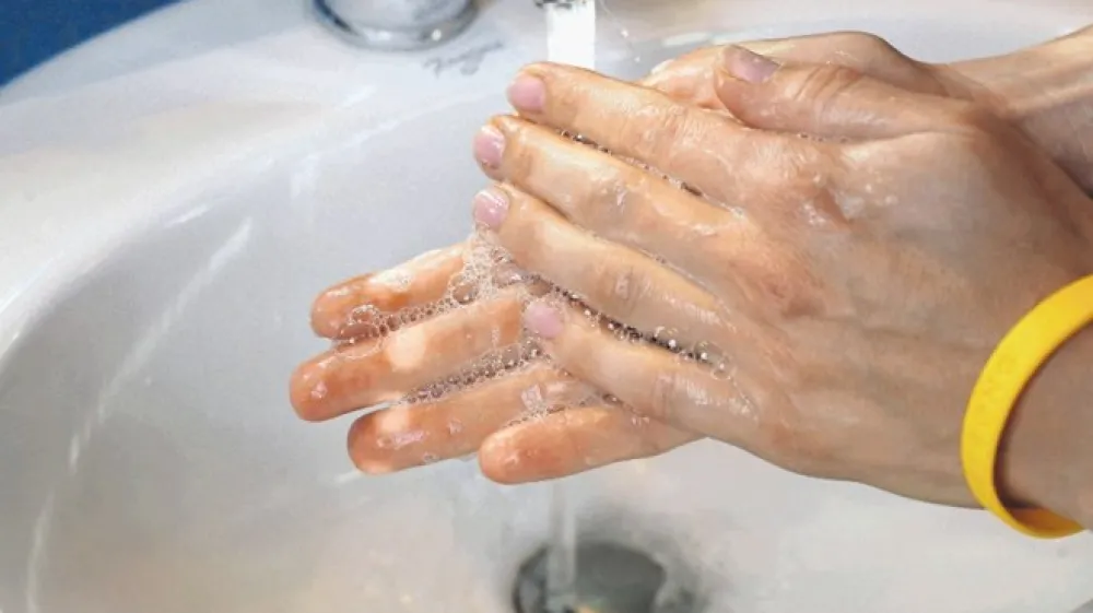 V UKC Ljubljana zatrjujejo, da je voda na Kliniki ORL z mikrobiolo&scaron;kega vidika neoporečna, čeprav je zaradi povi&scaron;ane vsebnosti železa nekoliko obarvana.