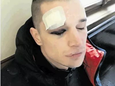 Klemen Rajnar trdi, da so ga policisti ob aretaciji poškodovali in nato zaslišali, ne da bi prej poklicali zdravnika in odvetnika.