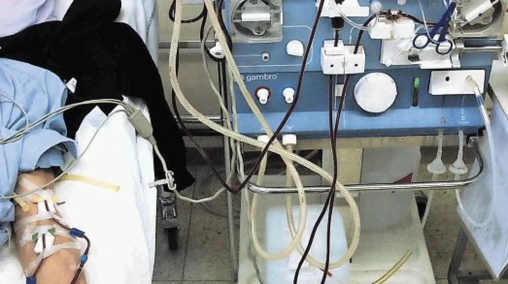 Dializni bolniki na posteljah ležijo vsak drugi dan po &scaron;tiri do &scaron;est ur, nekateri pa celo do osem ur.