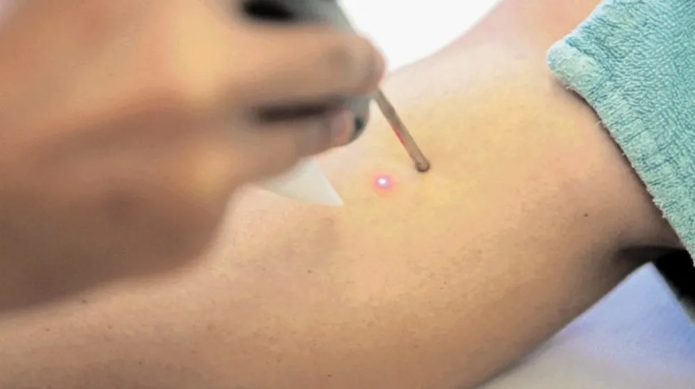 Dermatolo&scaron;ke storitve so v primerjavi z drugimi zdravstvenimi pregledi in posegi razmeroma  poceni.  Očitno si jih lahko privo&scaron;či toliko Ljubljančanov, da v glavnem mestu uspevajo samoplačni&scaron;ke klinike. Na drugi strani pa imajo zaradi tega težave tisti, ki računajo na javno zdravstveno mrežo.