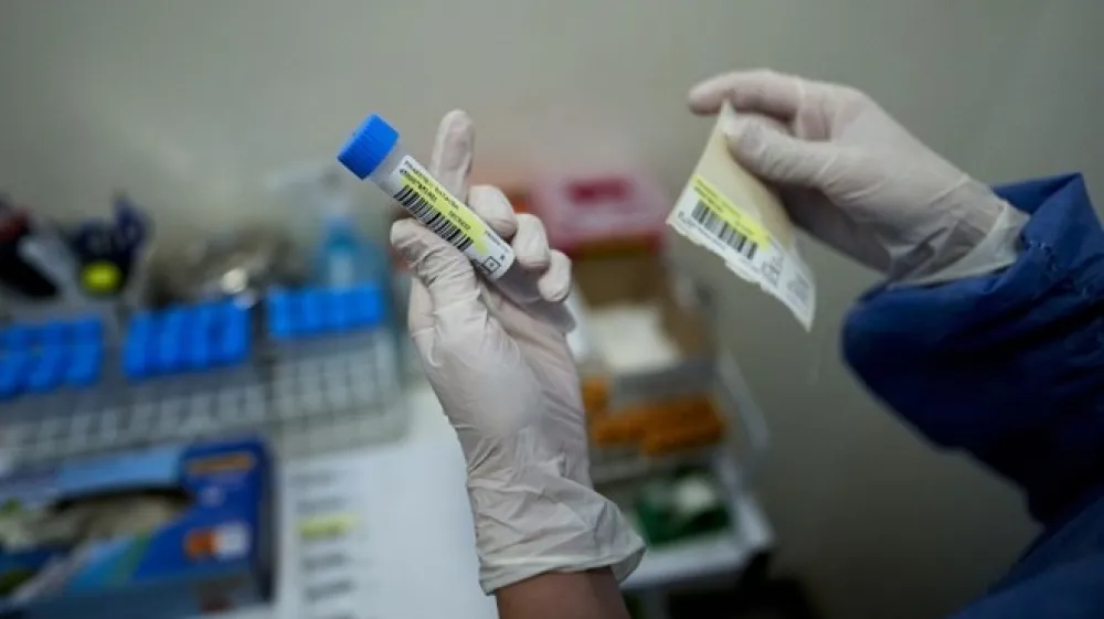 Fotografija je simbolična.