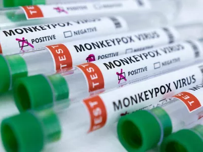 FILE PHOTO: Test tubes labeled "Monkeypox virus positive and negative" are seen in this illustration taken May 23, 2022. REUTERS/Dado Ruvic/Illustration/File Photo/File Photo