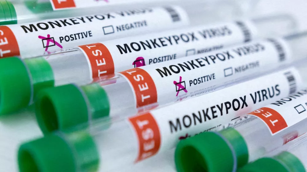 FILE PHOTO: Test tubes labeled "Monkeypox virus positive and negative" are seen in this illustration taken May 23, 2022. REUTERS/Dado Ruvic/Illustration/File Photo/File Photo