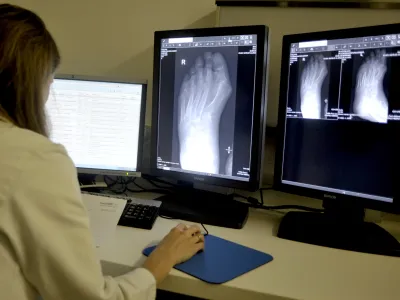 - ilustrativna fotografijarentgen, rentgenska slika, digitalni rentgen, radiologija, radiologinja, radiologi- Klinični in&scaron;titut za radiologijo UKC v Ljubljani ob mednarodnem dnevu radiologije predstavili nove metode zdravljenja;//FOTO: Tomaž Zajel&scaron;nik