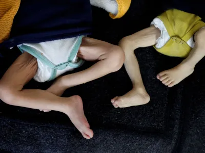 Palestinske otroke, ki trpijo zaradi podhranjenosti in vsesplošne lakote v Gazi, so odpeljali na zdravljenje v zdravstveni center v Rafi. Foto: Reuters