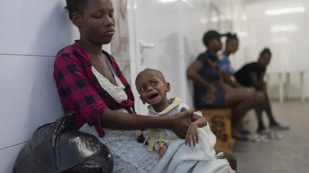 A malnourished child waits to be treated at a Doctors Without Borders emergency room in the Cite Soleil neighborhood of Port-au-Prince, Haiti, Friday, April 19, 2024. (AP Photo/Ramon Espinosa)