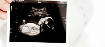 Nadomestno materinstvo Pixabay