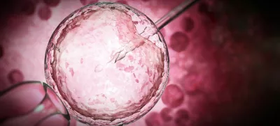 3D illustration of artificial insemination process showings sperms being injected inside the ovule. 3D illustration.,Image: 845750653, License: Royalty-free, Restrictions:, Model Release: noFoto: Profimedia