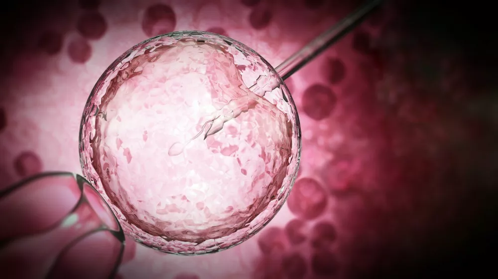 3D illustration of artificial insemination process showings sperms being injected inside the ovule. 3D illustration.,Image: 845750653, License: Royalty-free, Restrictions:, Model Release: noFoto: Profimedia