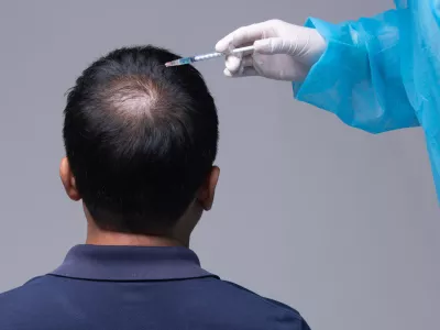 Aesthetics Doctor inject treatment serum vitamins to hair fall area on head by Syringe, Short Hair Loss control therapy clinic to prevent falling in working senior man woman, studio lighting isolated / Foto: Jadethaicatwalk