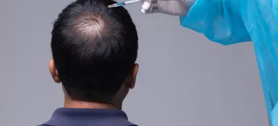 Aesthetics Doctor inject treatment serum vitamins to hair fall area on head by Syringe, Short Hair Loss control therapy clinic to prevent falling in working senior man woman, studio lighting isolated / Foto: Jadethaicatwalk