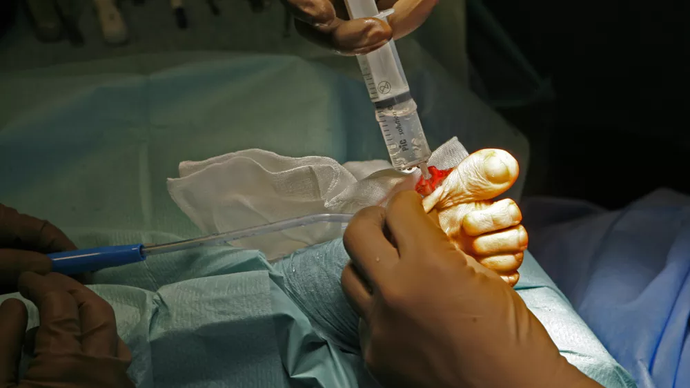 Prebivalci ob zadržanih pravicah ostanejo brez dostopa do številnih zdravljenj. Fotografija je simbolična. Foto: Tomaž Skale