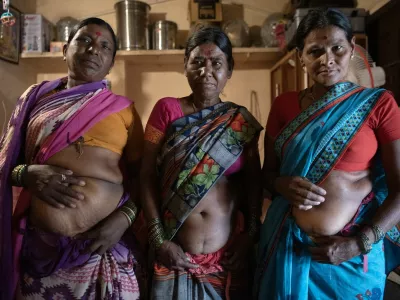 Women who work in the sugarcane fields, all of whom have undergone hysterectomy surgeries, show their scars in Wadgaon, India, May 22, 2023. In Maharashtra's sugar industry, everyone -- contractors, other workers, even doctors -- pushes women toward the surgery.,Image: 859360017, License: Rights-managed, Restrictions:, Model Release: no