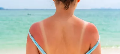 Posebej izpostavljena so ramena.