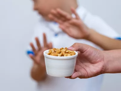 ﻿Peanut food allergy concept. Great concept of allergy and skin diseases. Nut allergies. No peanuts. Food allergy symptoms, Irritation