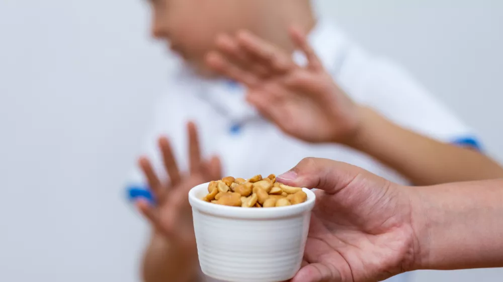 ﻿Peanut food allergy concept. Great concept of allergy and skin diseases. Nut allergies. No peanuts. Food allergy symptoms, Irritation