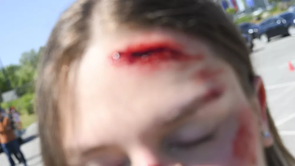 E - SKIROSKIRO SIMBOLIČNA FOTOGRAFIJAvarnost v prometu električni skiroprometna nesrečasmrt v prometupromettrčenjetrknasiljepoškodbe glavepoškodbaranakrinasilje nad ženskami14.05.2025 Novinarska konferenca: " Varno z e-skirojem "FOTO: Nik Erik Neubauer