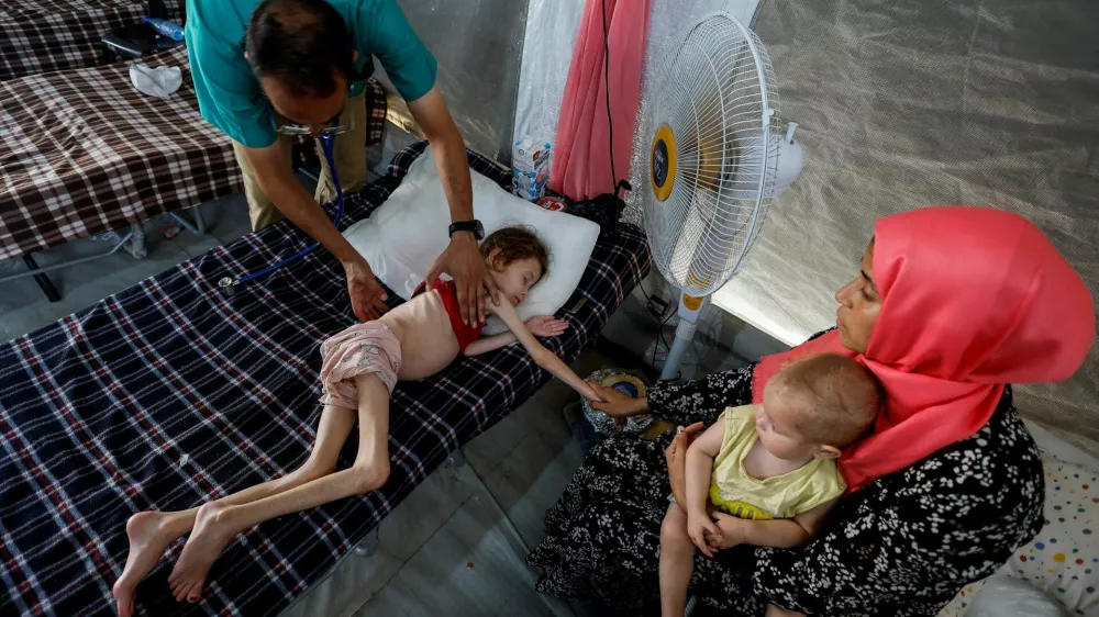 FILE PHOTO: A doctor checks Jana Ayad, a malnourished Palestinian girl, as she receives treatment at the International Medical Corps field hospital, amid the Israel-Hamas conflict, in Deir Al-Balah in the southern Gaza Strip, June 22, 2024. REUTERS/Mohammed Salem /File Photo