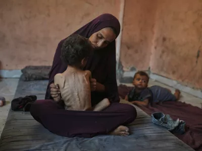 Naima Abu Ful poses for a photo with her 2-year-old malnourished child, Yazan, at their home in the Shati refugee camp in Gaza City, Wednesday, July 23, 2025. (AP Photo/Jehad Alshrafi)