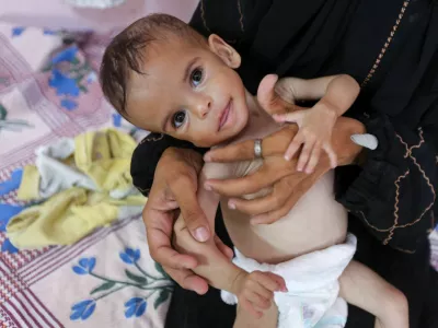 Seela Barbakh, an 11-month-old Palestinian girl who is malnourished, according to medics, is held by her mother, Najah, at Nasser Hospital in Khan Younis, in the southern Gaza Strip, July 23, 2025. REUTERS/Ramadan Abed