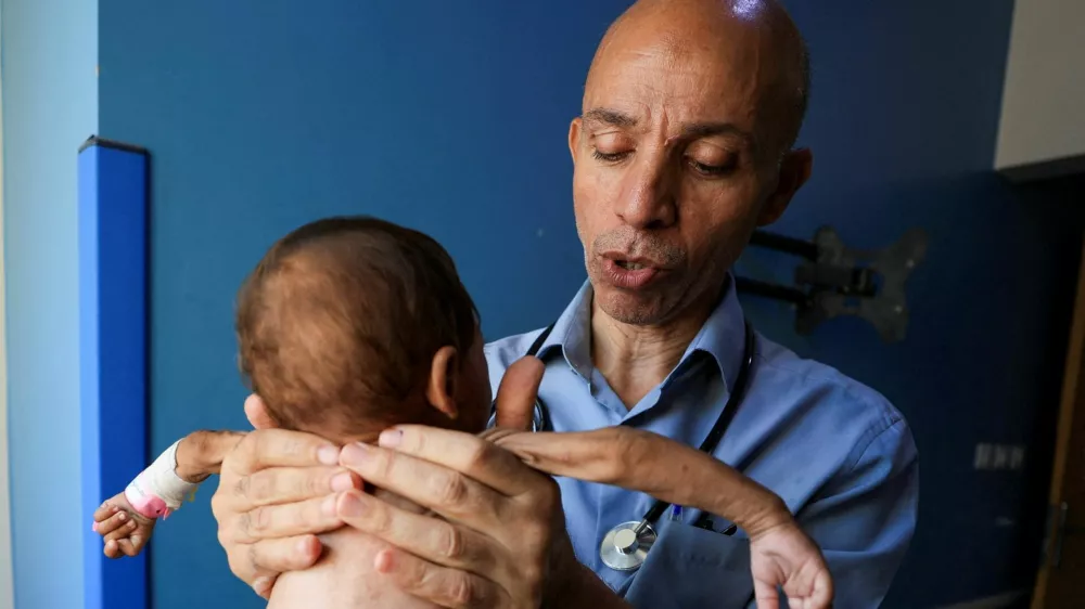 Palestinian doctor Ahmed Basal examines a child for malnutrition at Al-Rantisi Hospital in Gaza City, August 7, 2025. REUTERS/Dawoud Abu Alkas   TPX IMAGES OF THE DAY
