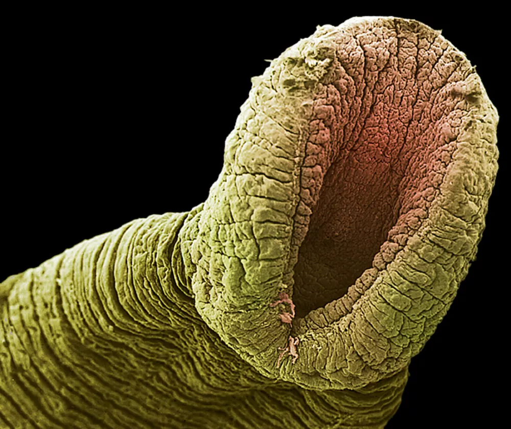 Freshwater leech's rear sucker. Coloured scanning electron micrograph (SEM) of the rear sucker of a freshwater leech (family Hirudinidae). This parasite has two suckers, one at each end of its body, that it uses to attach itself to the skin of its victim whilst it drinks their blood. The mouth is contained within the head sucker. Freshwater leeches are found in lakes and marshes, as well as slow-flowing streams. They feed on the blood of fish, amphibians and mammals.,Image: 103051121, License: Rights-managed, Restrictions:, Model Release: no / Foto: Profimedia