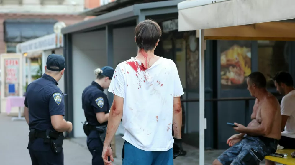 Priče so poročale o udarcih v glavo, glasnik krikih in prelivanju krvi, po pisanju hrvaških medijev pa naj bi eden od pretepačev segel celo po pištoli za žeblje. 