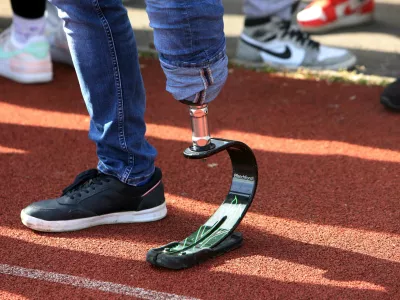 simbolična fotografija- nožna proteza, invalidnost- 19.04.2023 - dogodek 100 slovenskih športnikov in parašportnikov za en namen - V športu smo vsi enaki, na katerem je 85 športnikov in 15 parašportnikov s simbolno gesto pokazalo, da so invalidi kljub različnosti v življenju vsi enaki in da si vsi zaslužijo enake možnosti, hkrati pa obeležili 500 dni do paraolimpijskih iger v Parizu //FOTO: Tomaž Skale