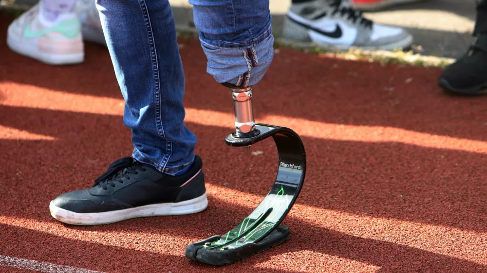 simbolična fotografija- nožna proteza, invalidnost- 19.04.2023 - dogodek 100 slovenskih športnikov in parašportnikov za en namen - V športu smo vsi enaki, na katerem je 85 športnikov in 15 parašportnikov s simbolno gesto pokazalo, da so invalidi kljub različnosti v življenju vsi enaki in da si vsi zaslužijo enake možnosti, hkrati pa obeležili 500 dni do paraolimpijskih iger v Parizu //FOTO: Tomaž Skale