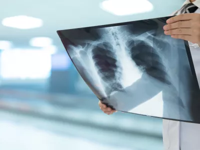 Zdravniki so uporabili vse, kar so imeli na voljo. Slika je simbolična. / Foto: Istock