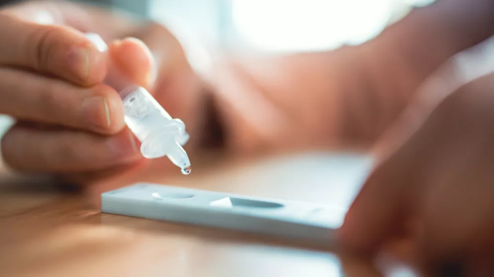 test je še vedno edini zanesljivi pokazatelj tega, za čem smo zboleli. / Foto: Istock