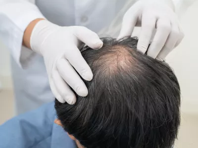 Zdravniški pregled lasišča