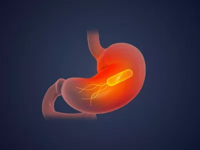 Helicobacter pylori. Prikaz: Profimedia