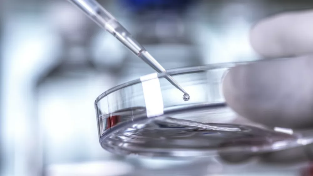 Simbolična fotografija: Profimedia