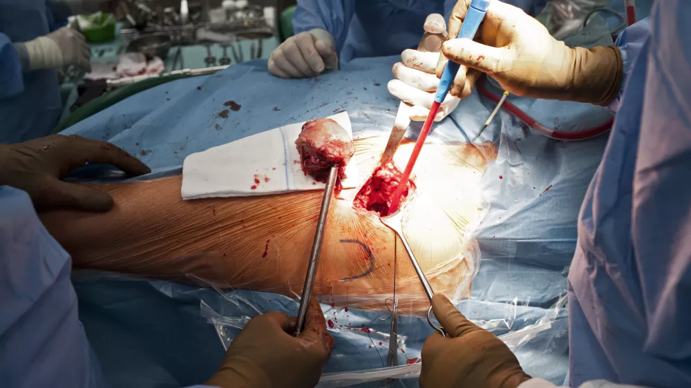 Država še ni določila metodologije obremenitve zdravnikov