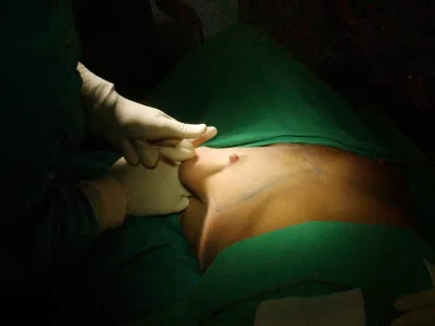 lepotna kirurgija, Glumičič Medical Group - lepotna kirurgija, Sini&scaron;a Glumičič