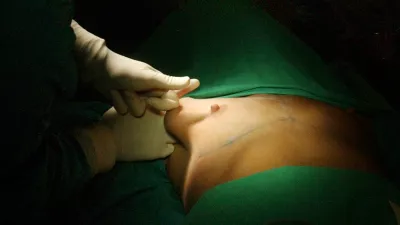 lepotna kirurgija, Glumičič Medical Group - lepotna kirurgija, Siniša Glumičič