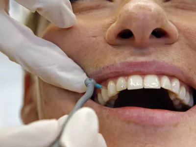 medzobna ščetkanje - ilustrativna fotografija - Dentalni studio dr. Škorjanc - Zasebna zobozdravstvena ordinacija - zobozdravstvo - Dunajska 198 v Ljubljani//FOTO: Bojan Velikonja