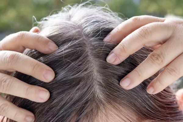Aging with grace and confidence, brown-haired woman with long brown hair with gray hair, female forehead close-up, hands hold strands of hair, Hair care and grooming for mature women / Foto: Victor Golmer