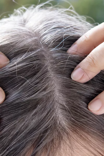 Aging with grace and confidence, brown-haired woman with long brown hair with gray hair, female forehead close-up, hands hold strands of hair, Hair care and grooming for mature women / Foto: Victor Golmer