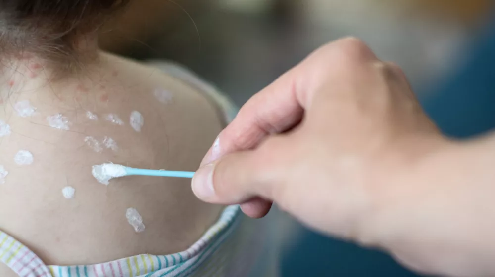 / Foto: Getty Images