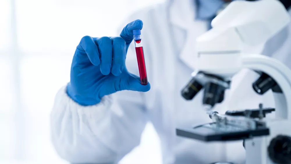Doctor hand taking a blood sample tube from a rack with machines of analysis in the lab background, Technician holding blood tube test in the research laboratory. / Foto: Perawit Boonchu