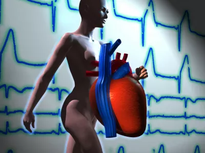 srce, infarkt, ilustracija