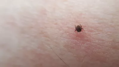 Tick Ixodes ricinus on human skin. tick wandering over human hand. Encephalitis tick