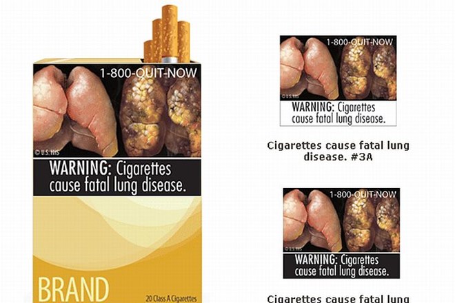 Cigarete lahko povzročijo usodno bolezen pljuč.