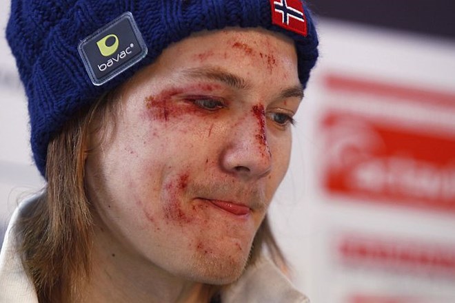 Za norveškega smučarskega skakalca Toma Hildeja je sezona 2011/12 po vsej verjetnosti že izgubljena.